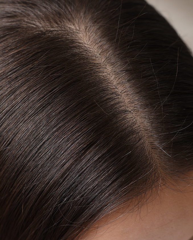 service-hairrestoration-image