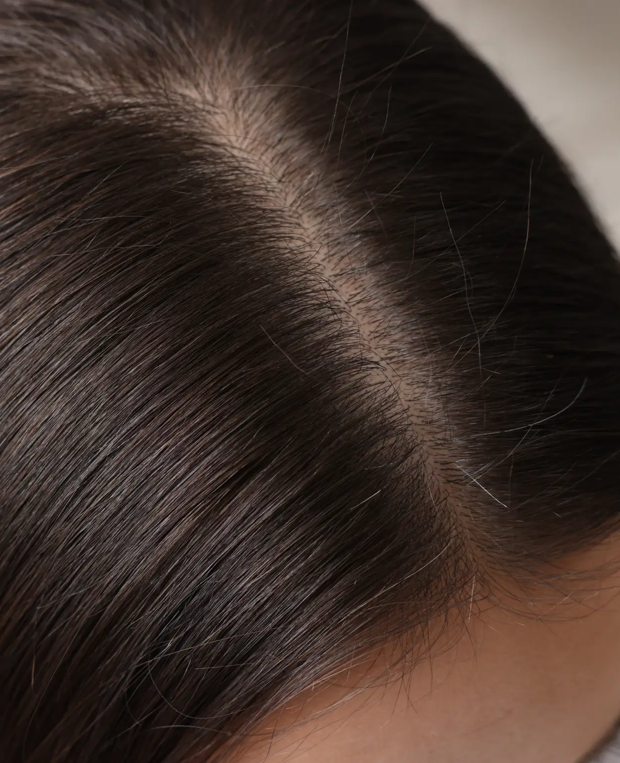 service-hairrestoration-image-1