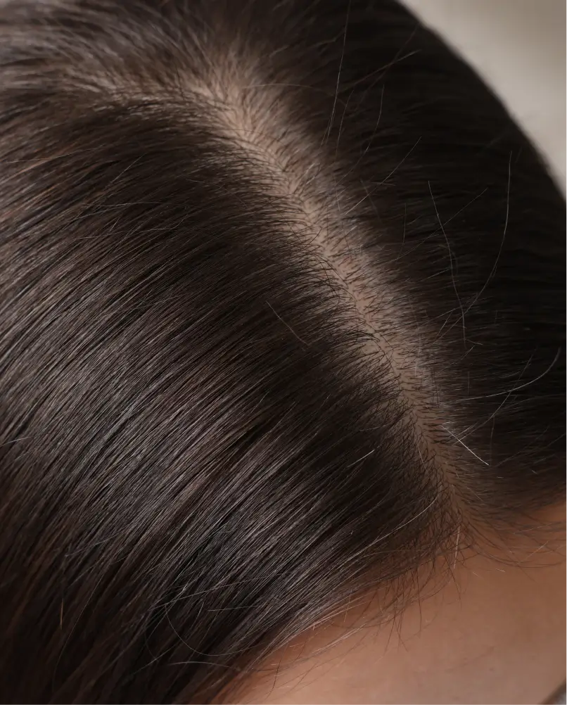 services-hair-restoration-4