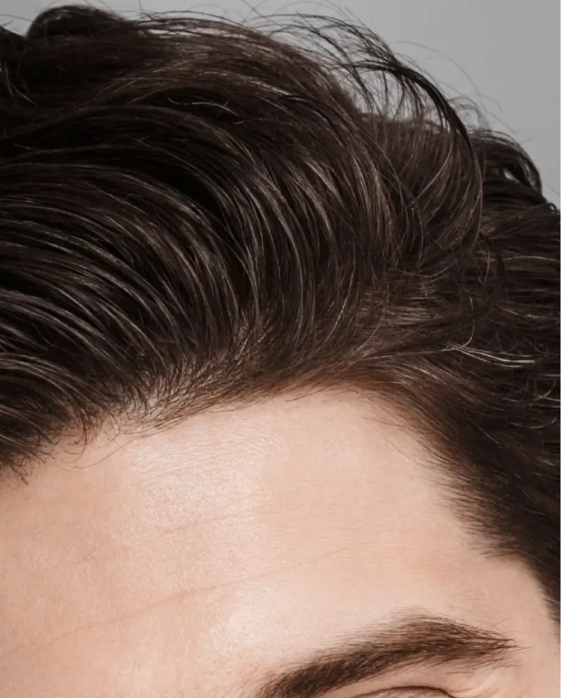 services-hair-restoration-7