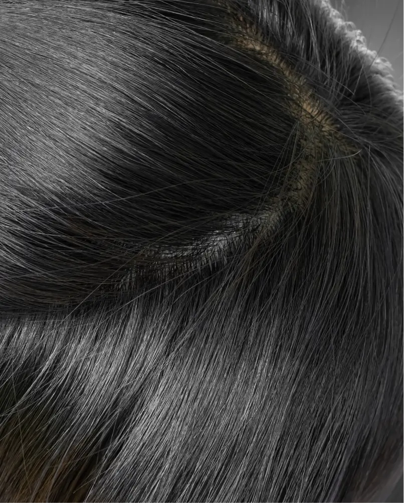 services-hair-restoration-8